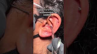 How to Treat Piercing Bumps on Tragus with Base Laboratories Piercing Bump Treatment
