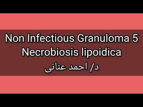 5-Necrobiosis lipoidica by Dr Ahmed Anany