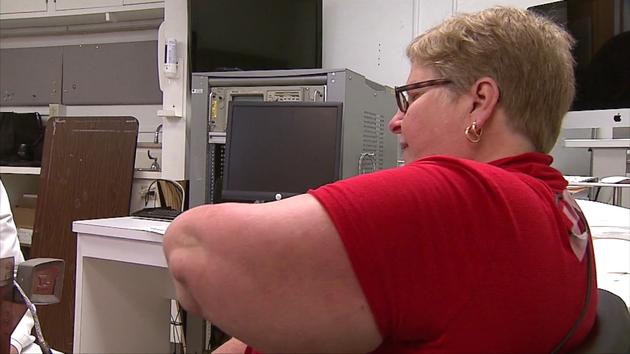 Brain Stimulation Helps Woman Recover From Stroke