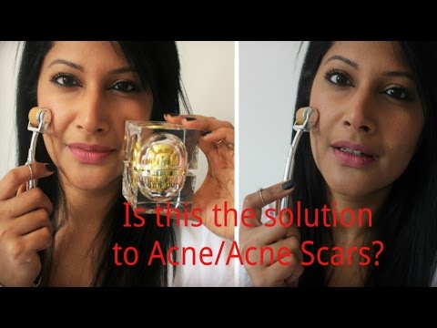 AME PURE REVIEW & NIGHT SKINCARE ROUTINE! Can Amepure solve your acne/acne scars? Video