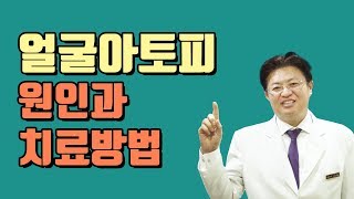 얼굴아토피치료 원인과 치료방법  [신덕일한의사의 피부보감TV]