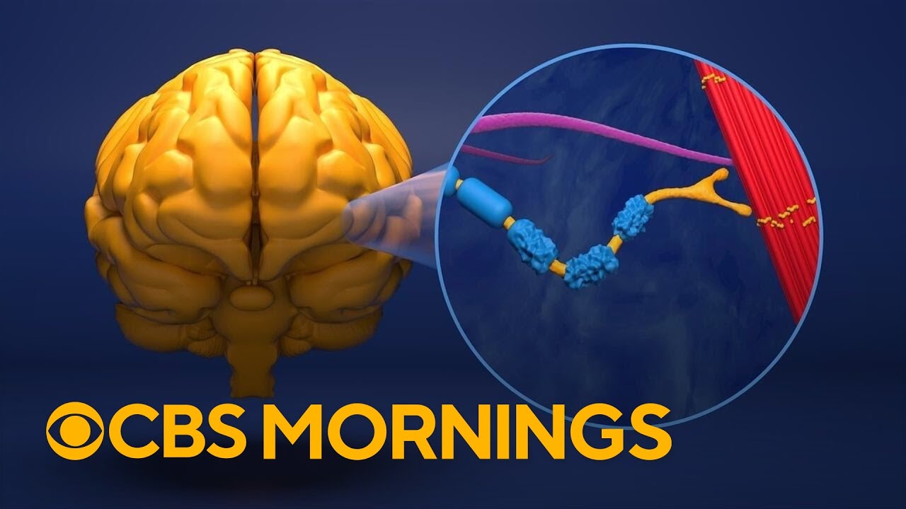 What is ALS? Here's what's known about the neurodegenerative disease