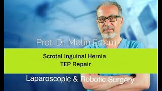Miniaturka - Scrotal Inguinal Hernia . TEP Repair.  Metin Ertem MD.FACS.