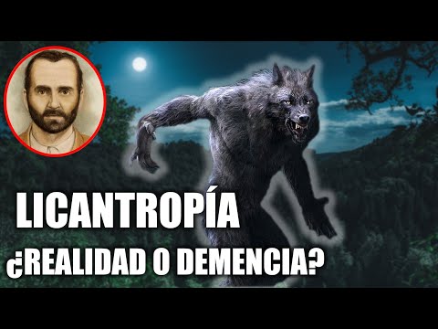 ¿Existen los HOMBRES LOBO? ¿O Sólo se Trata de un Padecimiento Psicológico? LICANTROPÍA CLÍNICA