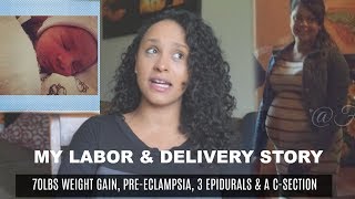 My Labor & Delivery Story| Preeclampsia, Emergency C-section, 70lb Weight Gain