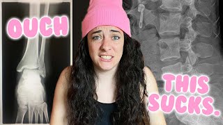 I hurt myself roller skating AGAIN :(