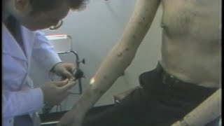 1983 NEWS SPECIAL: Diagnosis ( EARLY AIDS DOCUMENTARY )