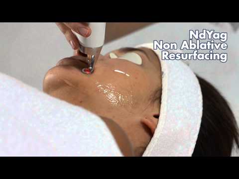 XLase - Supplied by The Harley Laser Specialists