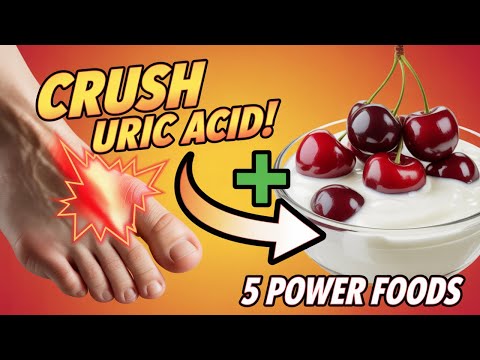 Smash Down Gout: 5 Power Foods to Crush Uric Acid NOW