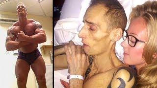 This Man Drank Energy Drinks Everyday  This Is What Happened To Him