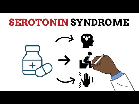 Serotonin Syndrome  MADE EASY  - Your professor made it too complicated