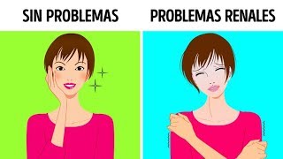 10 Señales de que tus riñones no están trabajando adecuadamente