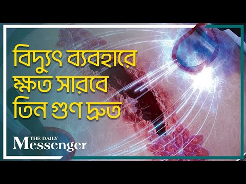 দীর্ঘস্থায়ী ক্ষত সারাতে বিজ্ঞানীদের নতুন আবিষ্কার