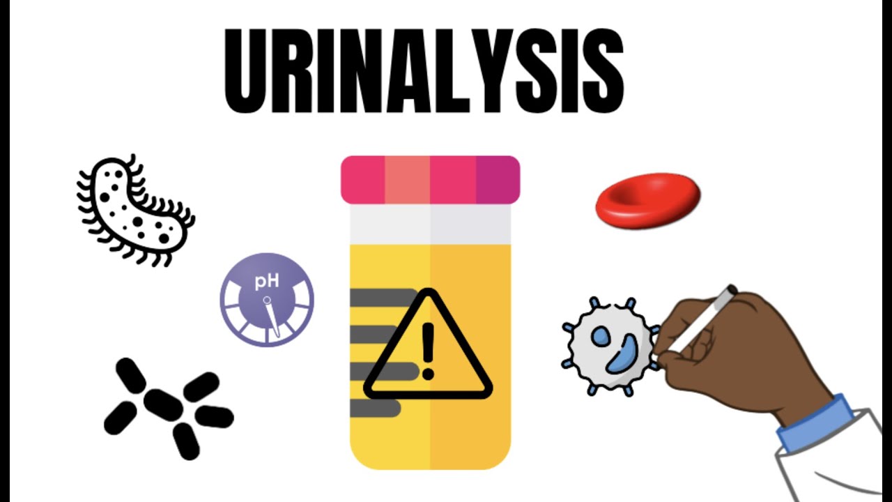 Urinalysis Interpretation QUICK and EASY