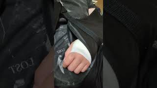躁鬱日記97日目#vlog＃手術#リハビリ