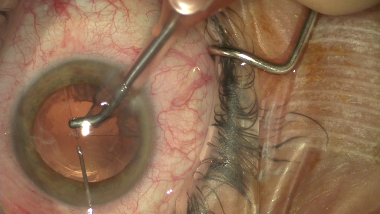 Biagio Giorgio Gagliano-5