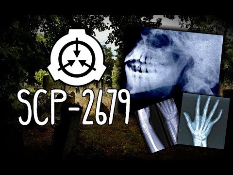 "The Many Graves of Jeannette Parslov" SCP-2679