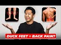 How To Fix Duck Feet Under 7 Mins