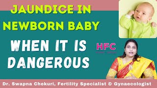 Jaundice In New Born Babies - Symptoms & Treatment || Dr Swapna Chekuri || HFC