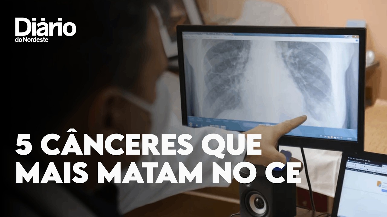 Imagem da notícia: Conheça os cinco tipos de câncer que mais matam no Ceará e saiba como se prevenir