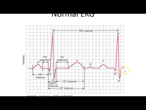 Cardiovascular #2: PCI, CABG, MI