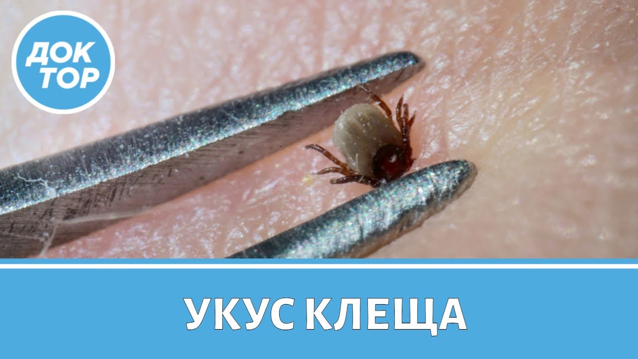 Где в России обитают инфицированные клещи