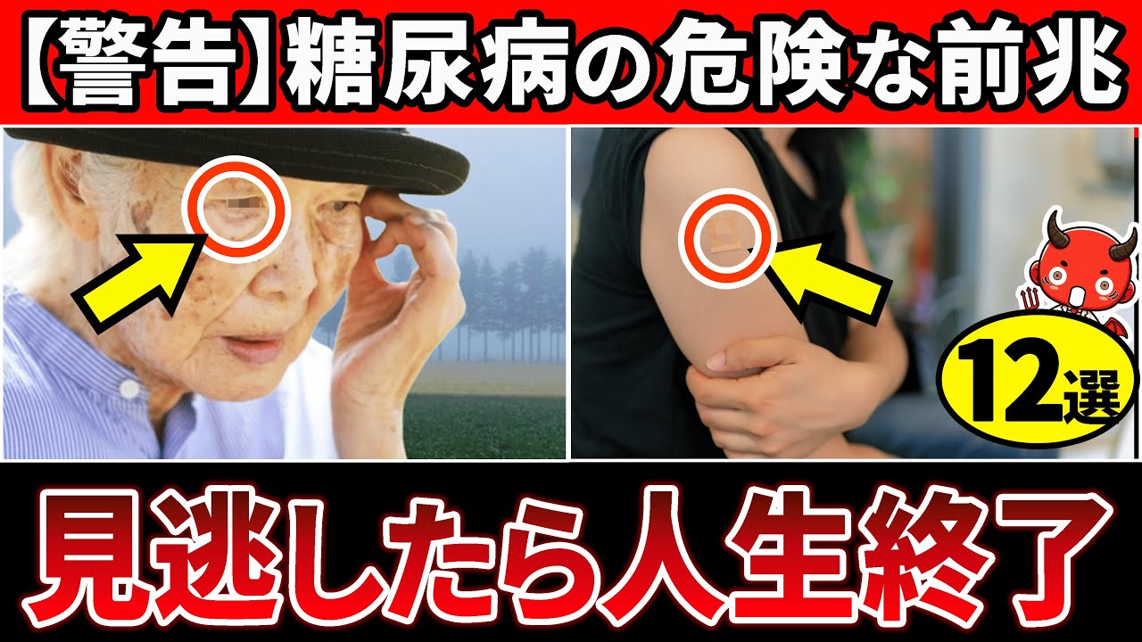 【警告】知らないと人生終了…血糖値が高いと体にでるサイン12選【糖尿病・高齢者・血糖値・HbA1c】