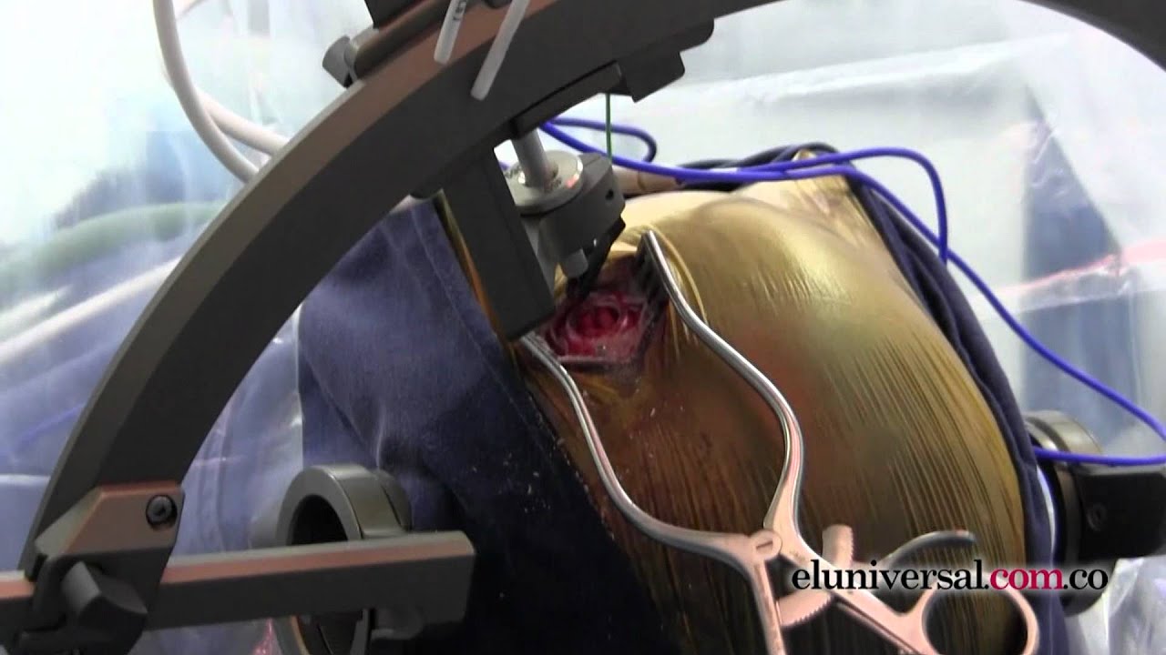 Juan Carlos Benedetti Isaac-18