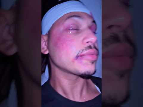 واش نستاهل كل هذ تمارة ❤️ 😂🤌 #اكسبلور #اهميه #el_mencho