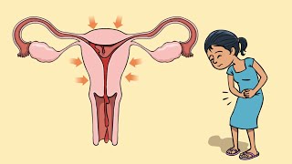 What are period cramps and how to deal with them?