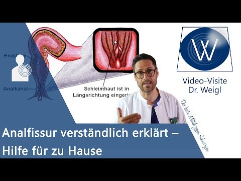 Diagnose Afterriss🙊 Schmerzhaft juckende Analfissur behandeln & Schmerzen beim Stuhlgang reduzieren