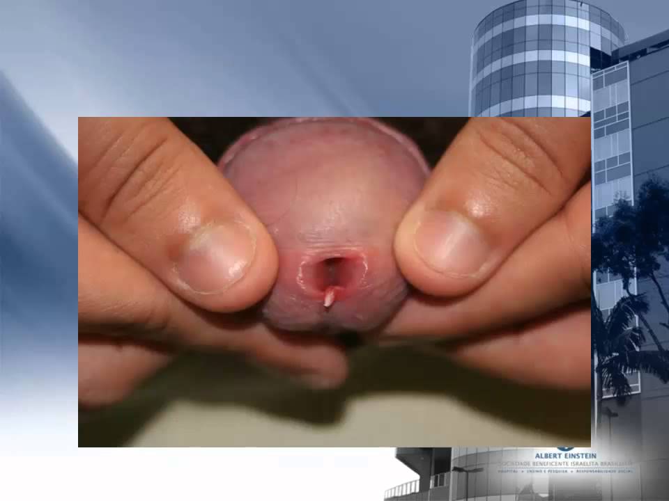 Charles Rosenblatt-33