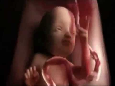 The Novadreams - The Novadreams - Cyborg Chicken On Acid