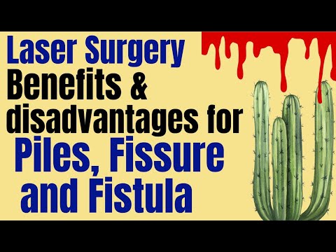Laser surgery for piles fissure and fistula Laser treatment for piles fissure and fistula benefit