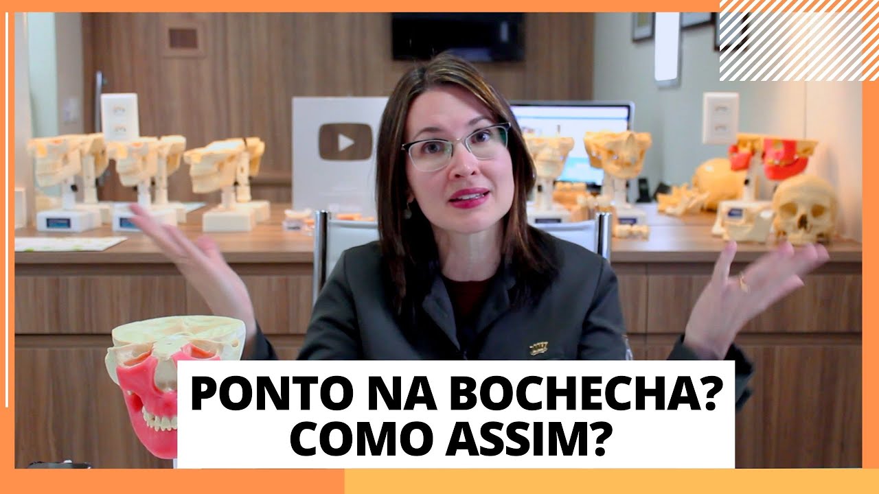 PONTO APÓS EXTRAÇÃO DE SISO – DRA. DANIELLE SALES