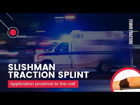 Slishman Traction Splint application proximal to the calf