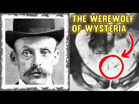 Albert Fish: The Werewolf of Wysteria