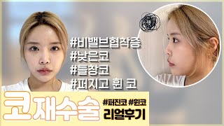 코성형 수술 전 리얼 후기 상담편  #코성형 #퍼진코 #낮은코 #휜코 #기능코 #코재수술