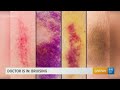 Why bruising matters and what the purple, blue, and yellow marks can indicate