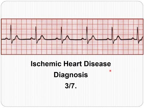 ECG Ischemic Heart Disease: diagnosis 3/7