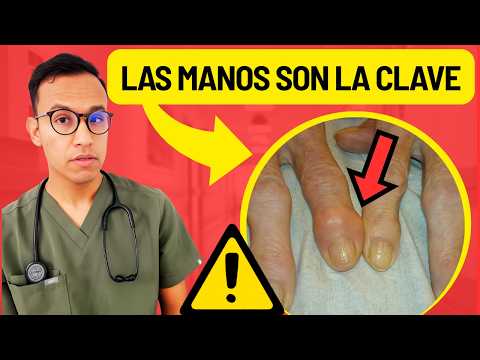 What your HANDS say about your HEALTH