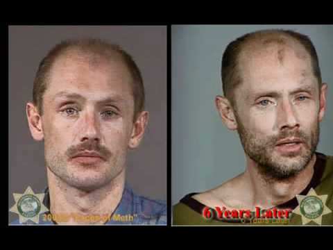 comment prendre forcapil