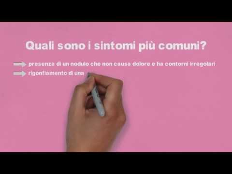 Movimento sottoastragalica in essa Dolorante dolore nella parte bassa della schiena si irradia alle gambe