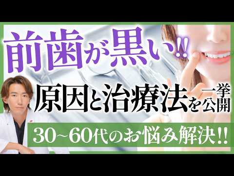 【絶対やらないで!!】歯が黒くなるNG行動と治療方法をプロが教えます！【前歯が黒い方限定】#ホワイトニング