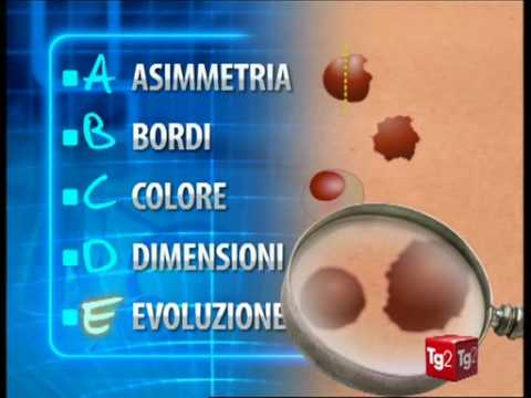 Mal di schiena nella zona delle lame Sport dopo borsite del ginocchio