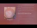Lavi Kou Pink Bubble Gum Lyrics