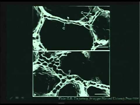 Intervento di Luciano Gattinoni parte 1 di 4