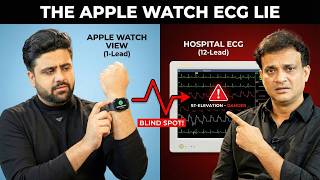 The Apple Watch ECG "Lie": Why It Misses Heart Attacks