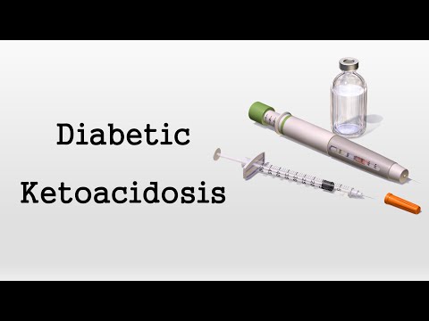 Diabetic Ketoacidosis (DKA)