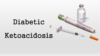 Download lagu Diabetic Ketoacidosis (DKA) mp3 Download lagu Diabetic Ketoacidosis (DKA) mp3
